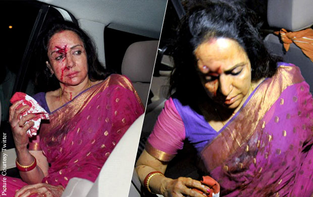 Hema Malini Injured In A Car Mishap