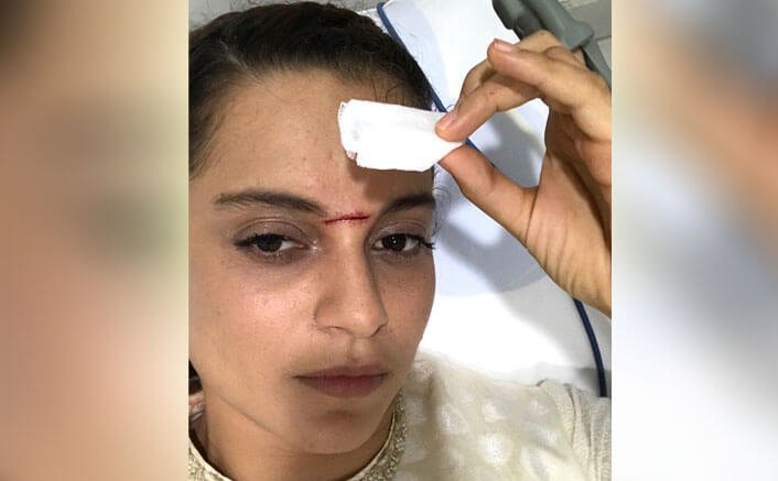 Kangana Ranaut Injured On The Sets Of Manikarnika - The Queen Of Jhansi