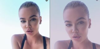 Fans slam Khloe Kardashian for her lip fillers in new pics