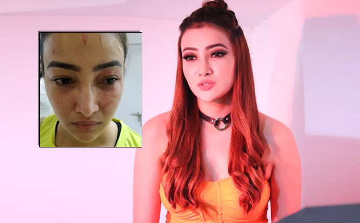 Naamkarann Actress Nalini Negi FINALLY Speaks About Being PHYSICALLY Assaulted By Her Roommate