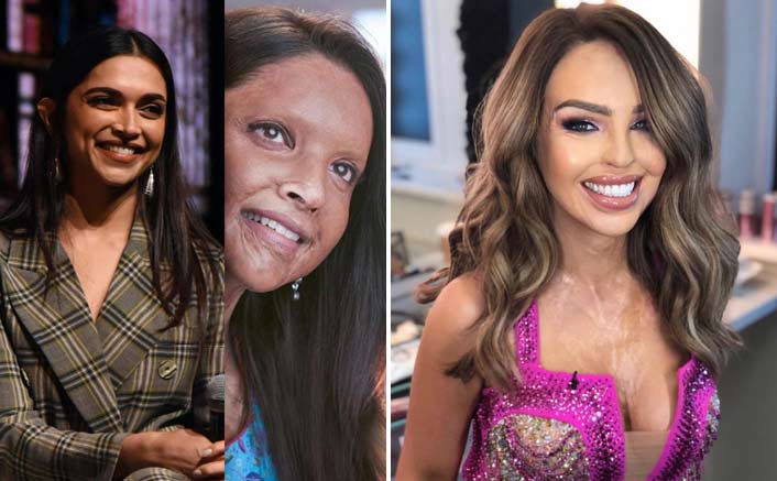 Chhapaak: Activist Katie Piper Lauds The Trailer; Deepika Padukone Responds With A Heartwarming Reply
