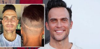 Cheyenne Jackson REVEALS The 'Devastating Truth' Of Undergoing 5 Hair Transplant Surgeries