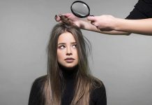 Dandruff Turning A Serious Concern? This Simple Homemade Mask Can Be A Life-Saver!