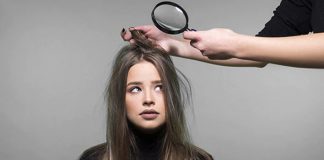 Dandruff Turning A Serious Concern? This Simple Homemade Mask Can Be A Life-Saver!