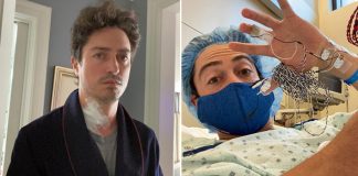 Ben Feldman Shares Pictures Post Undergoing A Spine Surgery