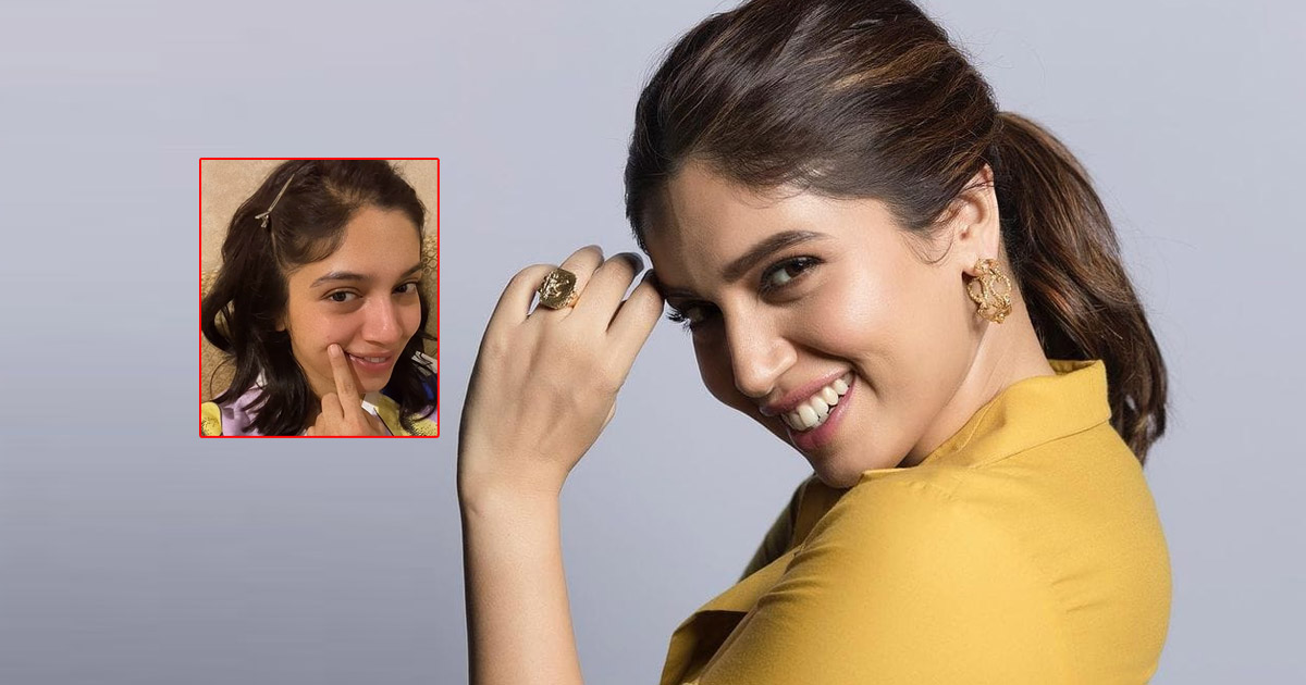 Bhumi Pednekar shares her pimple woes
