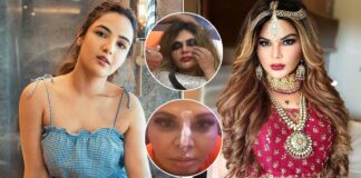 Rakhi Sawant Under Goes A Nose Surgery To Correct The Damage Caused During Her Fight With Jasmin Bhasin In The Bigg Boss 14 House