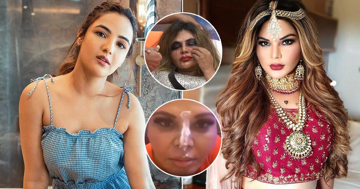 Rakhi Sawant Under Goes A Nose Surgery To Correct The Damage Caused During Her Fight With Jasmin Bhasin In The Bigg Boss 14 House