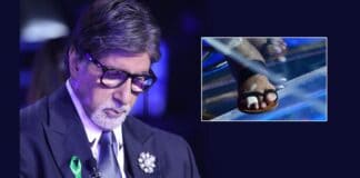 Big B shows fractured toes on sets of 'KBC 13'