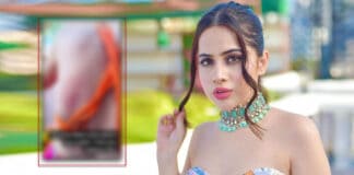 Bigg Boss OTT Contestant Urfi Javed Shows Off Her Lovebites!