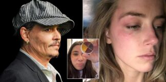 Amber Heard Exposed By TikTok User Who Shows How She Made Up Bruises & Blamed Johnny Depp For It – Watch Viral Video