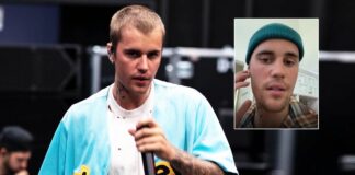 Justin Bieber Reveals Suffering Partial Face Paralysis