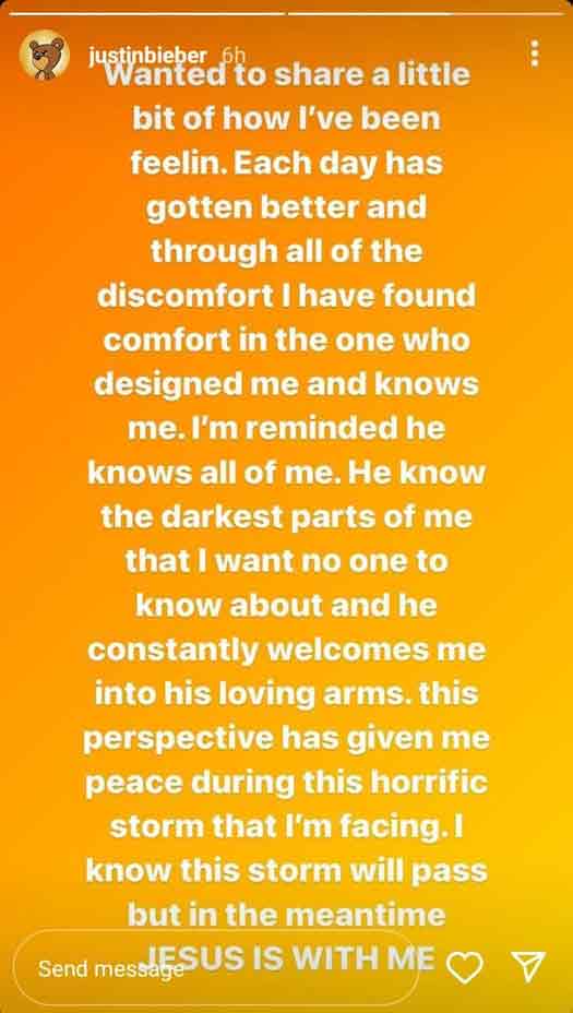 Justin Bieber Shares Update On Recovering From Ramsay Hunt Syndrome: “I Know This Storm Will Pass”