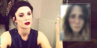 Victim of domestic abuse, French actress posts shocking pics on Instagram
