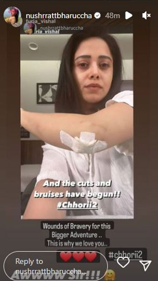 Nushrratt begins 'Chhorii 2' with cuts and bruises