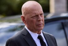 Bruce Willis Now Diagnosed With Dementia After Retiring Due To Aphasia Bruce Willis diagnosed with dementia after retiring due to aphasia