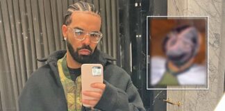 Netizens Troll Drake For His New Owl-Braided Hair