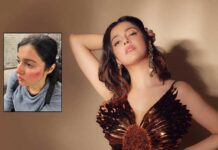 Divya Khosla Kumar Badly Injures Herself While Filming, Shared Pics Writing “The Show Must Go On” Divya Khosla Kumar gets injured while shooting for her upcoming project