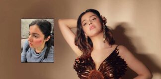 Divya Khosla Kumar gets injured while shooting for her upcoming project