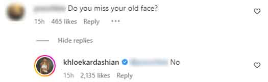Khloe Kardashian Shuts Down A Troll For Asking Whether She Misses Her 'Old Face', Her Response Leaves The Netizens In Splits