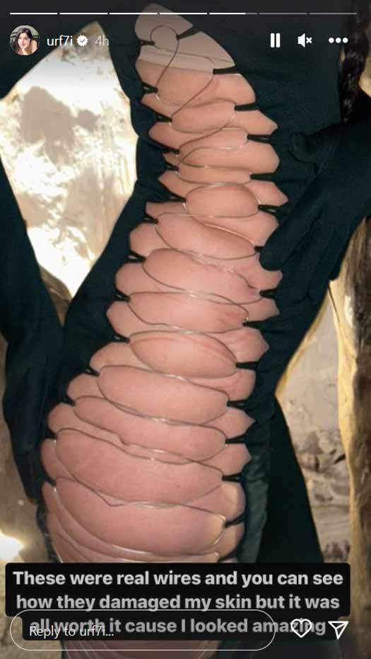 Uorfi Javed Gets Bruised In A Tight Bodycon Dress Made Up Of Real Wires, Netizens Ask Her To Attend Met Gala