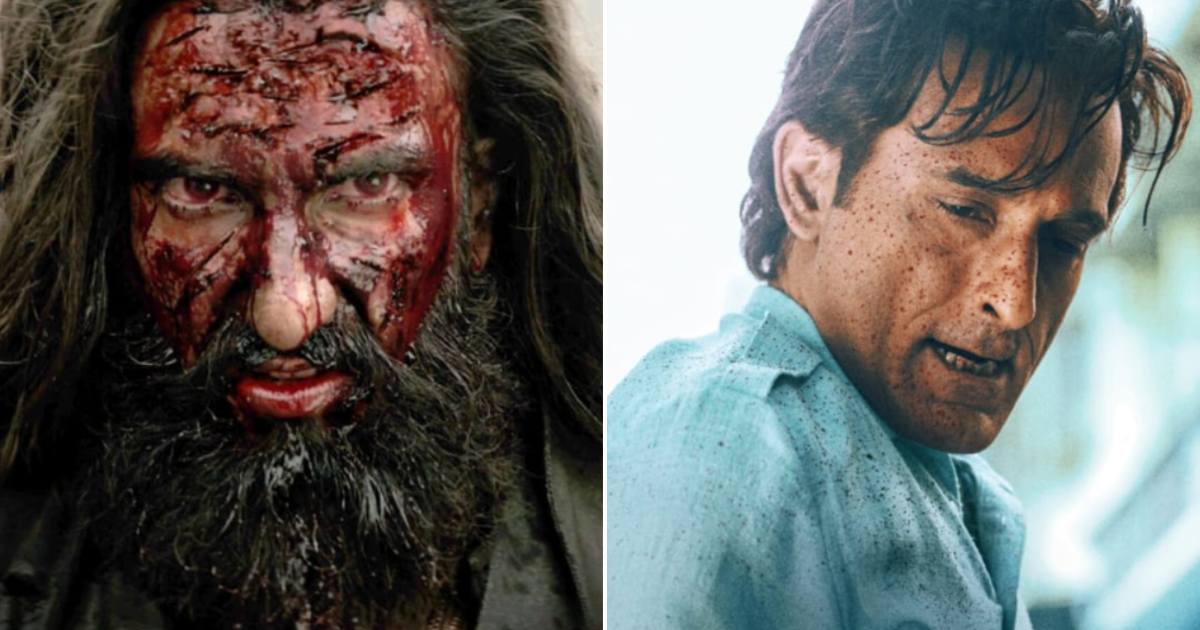 Prosthetics That Made Dhurandhar’s Scars and Head Injuries Unsettlingly Real